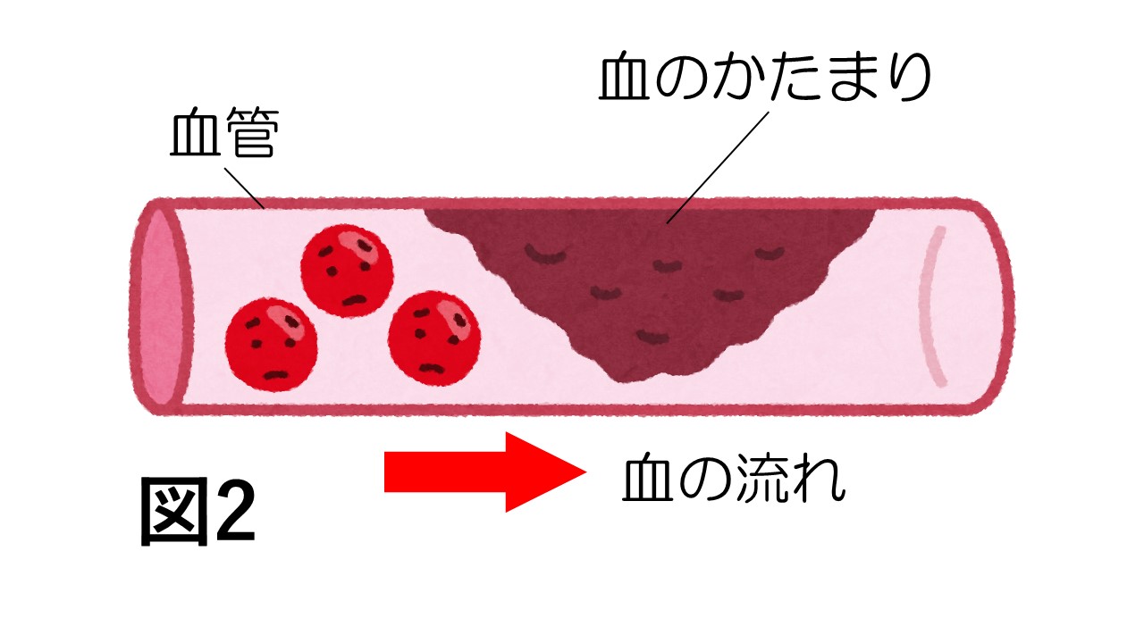 ncds8_図２血管